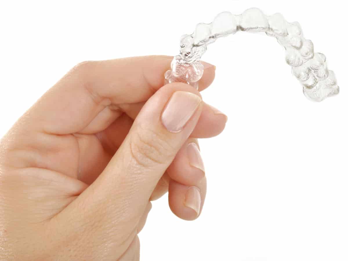 Clear Aligners Treatment in Lahore